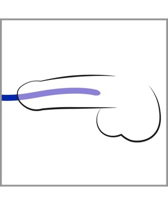 Silicone Dilator Set