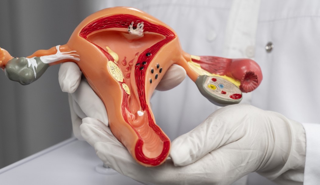 Grzybica pochwy – kandydoza: objawy, przyczyny, leczenie i profilaktyka